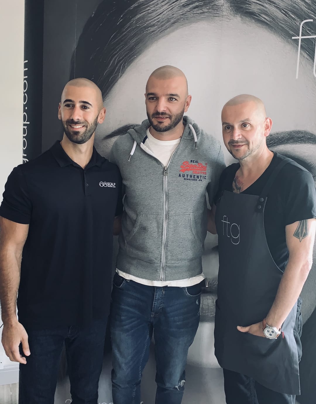 SMP tretman - fotografija iz galerije Micro Hair Clinic