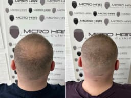 SMP galerija thumbnail 3