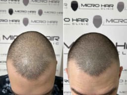 SMP galerija thumbnail 5