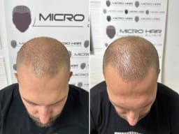 SMP galerija thumbnail 7