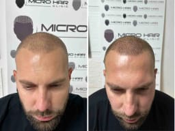 SMP galerija thumbnail 8