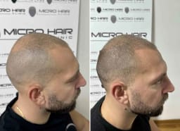 SMP galerija thumbnail 10