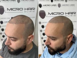 SMP galerija thumbnail 2