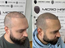 SMP galerija thumbnail 3