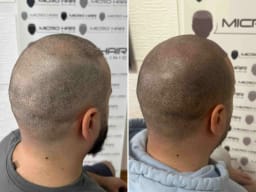 SMP galerija thumbnail 4