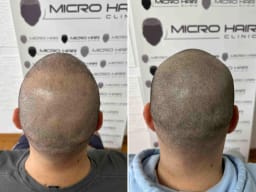 SMP galerija thumbnail 6