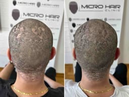 SMP galerija thumbnail 8