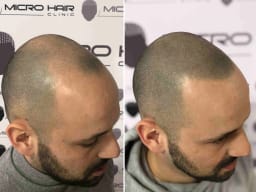 SMP galerija thumbnail 10