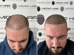 SMP galerija thumbnail 12