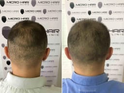 SMP galerija thumbnail 15