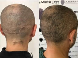 SMP galerija thumbnail 1