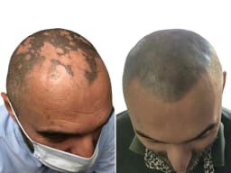 SMP galerija thumbnail 3