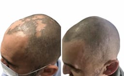 SMP galerija thumbnail 4