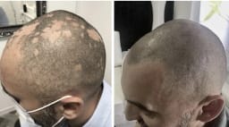 SMP galerija thumbnail 8