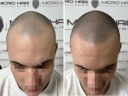 SMP galerija thumbnail 1