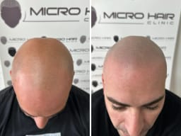 SMP galerija thumbnail 11