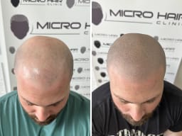 SMP galerija thumbnail 13