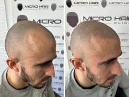 SMP galerija thumbnail 4