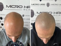 SMP galerija thumbnail 5