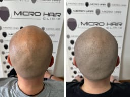 SMP galerija thumbnail 6