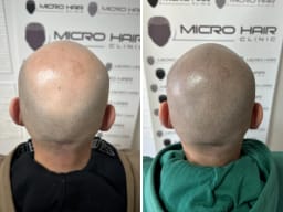 SMP galerija thumbnail 8