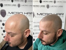 SMP galerija thumbnail 9