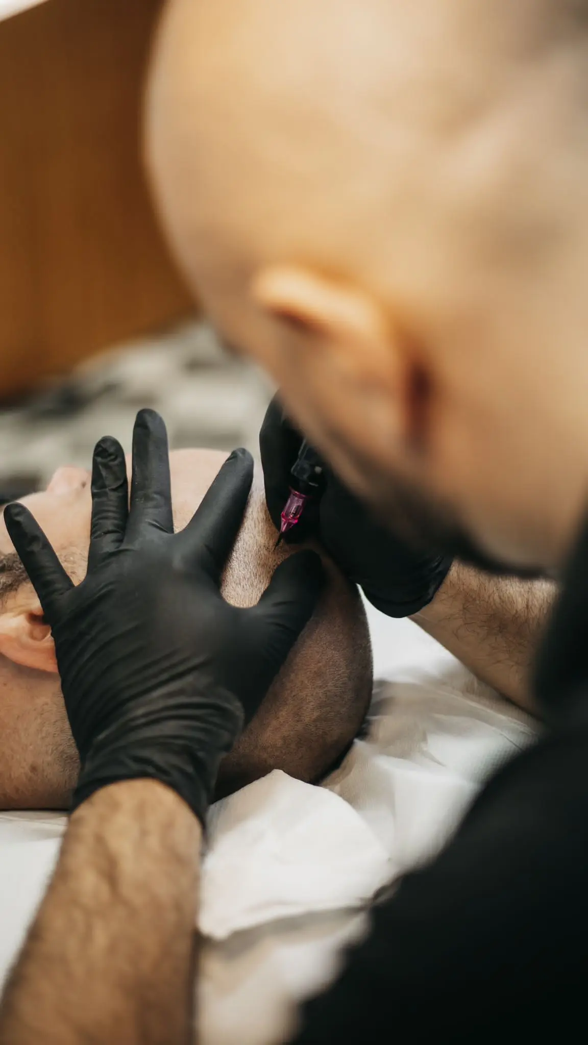 Korekcija SMP tretmaja s sivim pigmentom