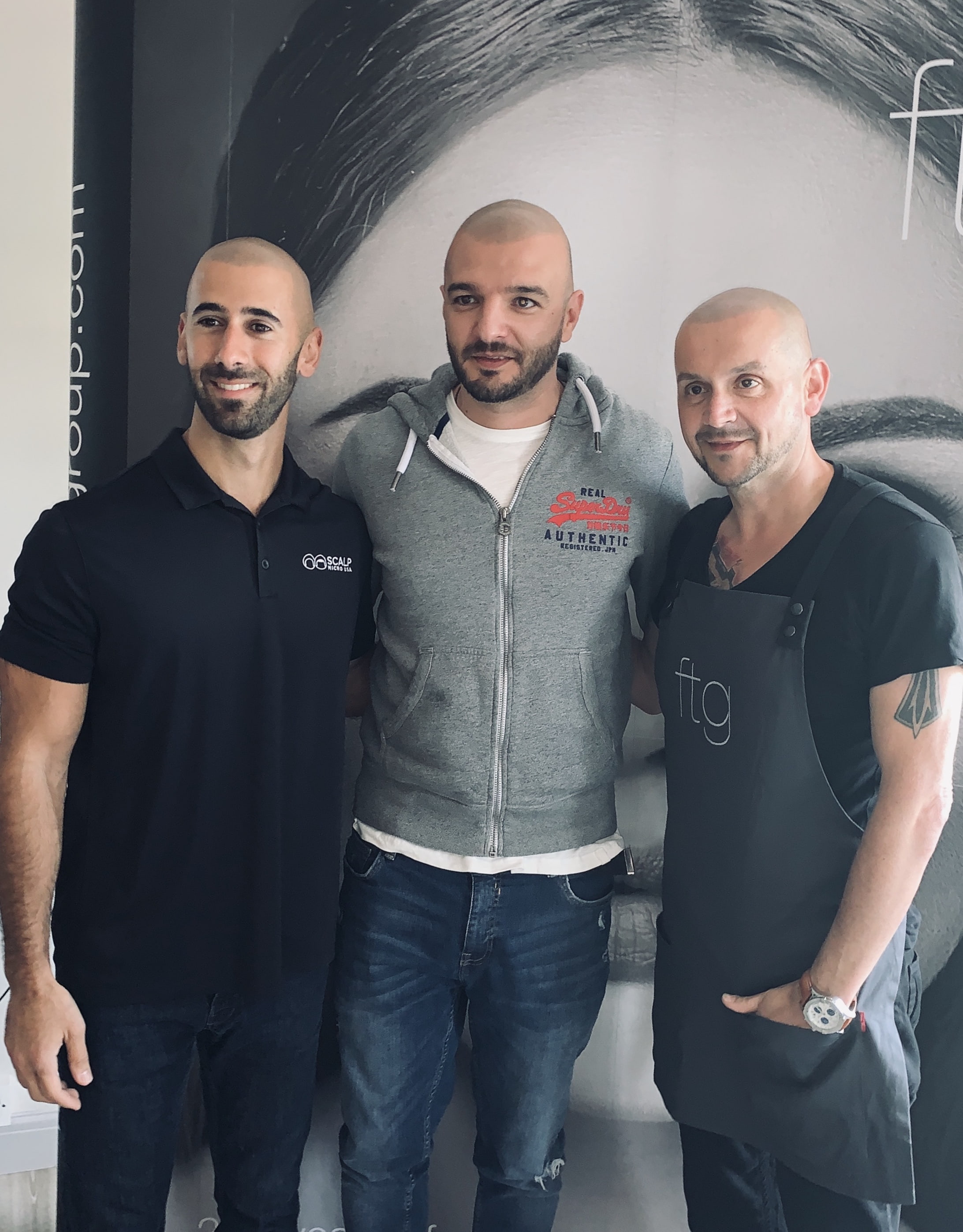 SMP tretman - fotografija iz galerije Micro Hair Clinic